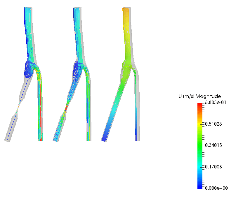 Velocity contours of blood flow through arteries