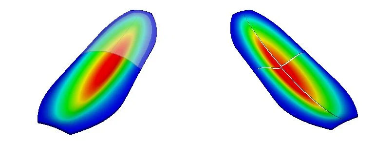 FEA simulations of Quantex' pump design performed with SimScale